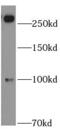 ATP Binding Cassette Subfamily A Member 2 antibody, FNab00027, FineTest, Western Blot image 