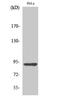 Adenosine Monophosphate Deaminase 2 antibody, A05817-1, Boster Biological Technology, Western Blot image 