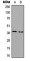 Acyl-CoA Wax Alcohol Acyltransferase 1 antibody, orb304693, Biorbyt, Western Blot image 