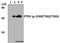 Phosphatase And Tensin Homolog antibody, A00006S380T382T383, Boster Biological Technology, Western Blot image 