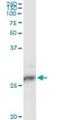 Major Histocompatibility Complex, Class II, DP Beta 1 antibody, H00003115-M01, Novus Biologicals, Immunoprecipitation image 