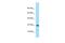 Ribosomal Protein S10 antibody, A06898-1, Boster Biological Technology, Western Blot image 