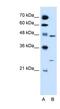 Retinoid X Receptor Gamma antibody, NBP1-52815, Novus Biologicals, Western Blot image 