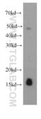 Fragile Histidine Triad Diadenosine Triphosphatase antibody, 66086-1-Ig, Proteintech Group, Western Blot image 