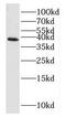 Homer Scaffold Protein 2 antibody, FNab03964, FineTest, Western Blot image 