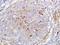 Interleukin 1 Receptor Associated Kinase 1 antibody, orb1678, Biorbyt, Immunohistochemistry paraffin image 