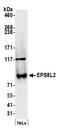 EPS8 Like 2 antibody, A301-841A, Bethyl Labs, Western Blot image 