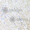 L-2-Hydroxyglutarate Dehydrogenase antibody, A7996, ABclonal Technology, Immunohistochemistry paraffin image 