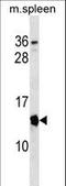 CDKN2A antibody, LS-C158187, Lifespan Biosciences, Western Blot image 