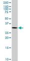 Pyrroline-5-Carboxylate Reductase 1 antibody, H00005831-D01P, Novus Biologicals, Western Blot image 
