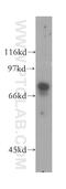Guanylate Cyclase 1 Soluble Subunit Alpha 1 antibody, 12605-1-AP, Proteintech Group, Western Blot image 