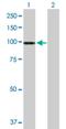 ATPase Secretory Pathway Ca2+ Transporting 1 antibody, H00027032-B01P, Novus Biologicals, Western Blot image 