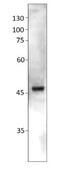 Atypical Chemokine Receptor 3 antibody, GTX82935, GeneTex, Western Blot image 