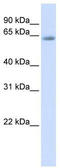 Transcription Factor 7 Like 2 antibody, TA333646, Origene, Western Blot image 