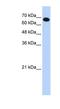 Coiled-coil domain-containing protein 38 antibody, NBP1-56363, Novus Biologicals, Western Blot image 