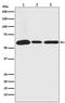 Ubiquitin Specific Peptidase 14 antibody, M03042, Boster Biological Technology, Western Blot image 