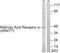 Retinoic Acid Receptor Alpha antibody, LS-C199534, Lifespan Biosciences, Western Blot image 