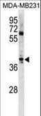 Atonal BHLH Transcription Factor 1 antibody, LS-C157561, Lifespan Biosciences, Western Blot image 