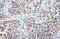 Nuclear Receptor Subfamily 3 Group C Member 1 antibody, GTX113208, GeneTex, Immunohistochemistry paraffin image 