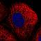 Cystinosin, Lysosomal Cystine Transporter antibody, PA5-65461, Invitrogen Antibodies, Immunofluorescence image 