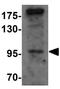 Salt Inducible Kinase 2 antibody, GTX32010, GeneTex, Western Blot image 