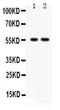 TNF receptor-associated factor 2 antibody, PB9516, Boster Biological Technology, Western Blot image 