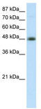 Transcription Factor AP-2 Beta antibody, TA334021, Origene, Western Blot image 