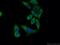 Collagen Type IV antibody, 19674-1-AP, Proteintech Group, Immunofluorescence image 