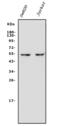 Gasdermin D antibody, A02842, Boster Biological Technology, Western Blot image 