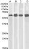 Catalase antibody, LS-B3014, Lifespan Biosciences, Western Blot image 