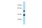 Ankyrin Repeat And SOCS Box Containing 4 antibody, A09401, Boster Biological Technology, Western Blot image 