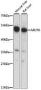 Nuclear Receptor Subfamily 2 Group F Member 6 antibody, A15271, ABclonal Technology, Western Blot image 