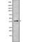 Serine And Arginine Rich Splicing Factor 6 antibody, abx218768, Abbexa, Western Blot image 