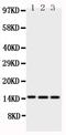 Homeobox A1 antibody, PA1745-1, Boster Biological Technology, Western Blot image 