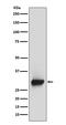 Calbindin 2 antibody, M04255, Boster Biological Technology, Western Blot image 