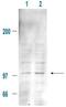 MDM2 Proto-Oncogene antibody, GTX21094, GeneTex, Western Blot image 