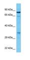 Rabenosyn, RAB Effector antibody, orb324467, Biorbyt, Western Blot image 