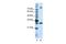 Serine And Arginine Rich Splicing Factor 10 antibody, GTX47232, GeneTex, Western Blot image 