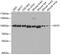 Hyperpolarization Activated Cyclic Nucleotide Gated Potassium Channel 1 antibody, GTX54130, GeneTex, Western Blot image 