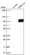 Erythrocyte Membrane Protein Band 4.1 Like 5 antibody, NBP2-30920, Novus Biologicals, Western Blot image 