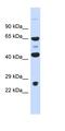 Kelch Like Family Member 41 antibody, orb324522, Biorbyt, Western Blot image 