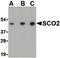 SCO Cytochrome C Oxidase Assembly Protein 2 antibody, orb86746, Biorbyt, Western Blot image 