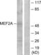 Myocyte Enhancer Factor 2A antibody, LS-C118175, Lifespan Biosciences, Western Blot image 