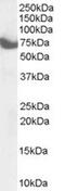 Zinc Finger DHHC-Type Containing 17 antibody, MBS420936, MyBioSource, Western Blot image 