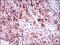 Fms Related Tyrosine Kinase 3 antibody, GTX60777, GeneTex, Immunohistochemistry paraffin image 