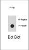 Integrin Linked Kinase antibody, abx032016, Abbexa, Dot Blot image 