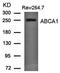 ATP Binding Cassette Subfamily A Member 1 antibody, orb69649, Biorbyt, Western Blot image 