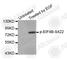 Eukaryotic Translation Initiation Factor 4B antibody, AP0278, ABclonal Technology, Western Blot image 