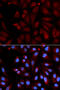 Monoamine Oxidase B antibody, 16-178, ProSci, Immunofluorescence image 