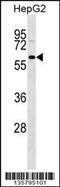GDNF Family Receptor Alpha 3 antibody, 58-409, ProSci, Western Blot image 